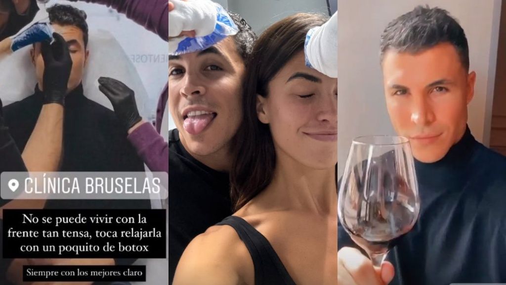Kiko Jiménez también ha recurrido a la toxina botulímica para lucir terso