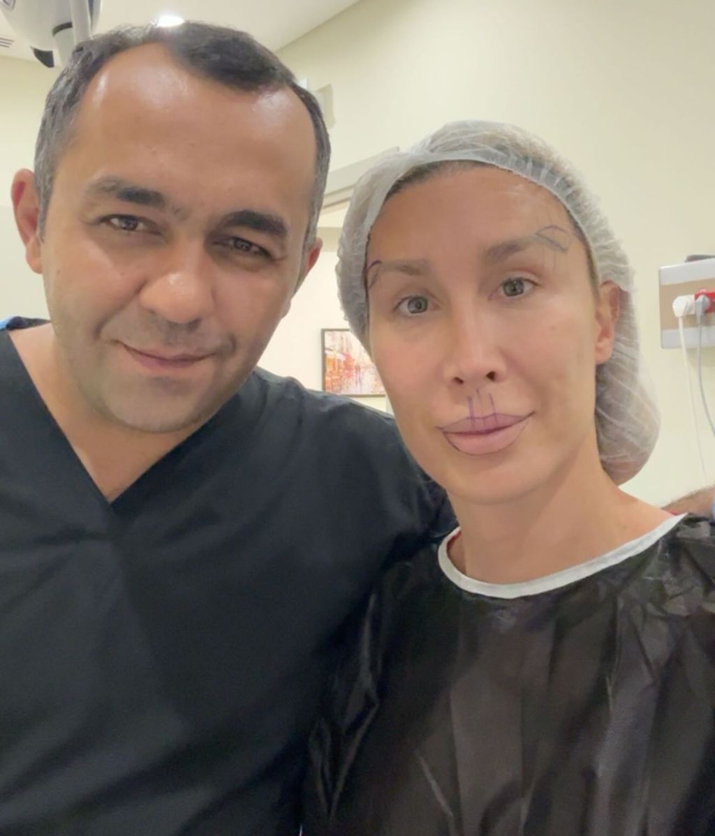 La Pelopony, antes de su paso por quirófano