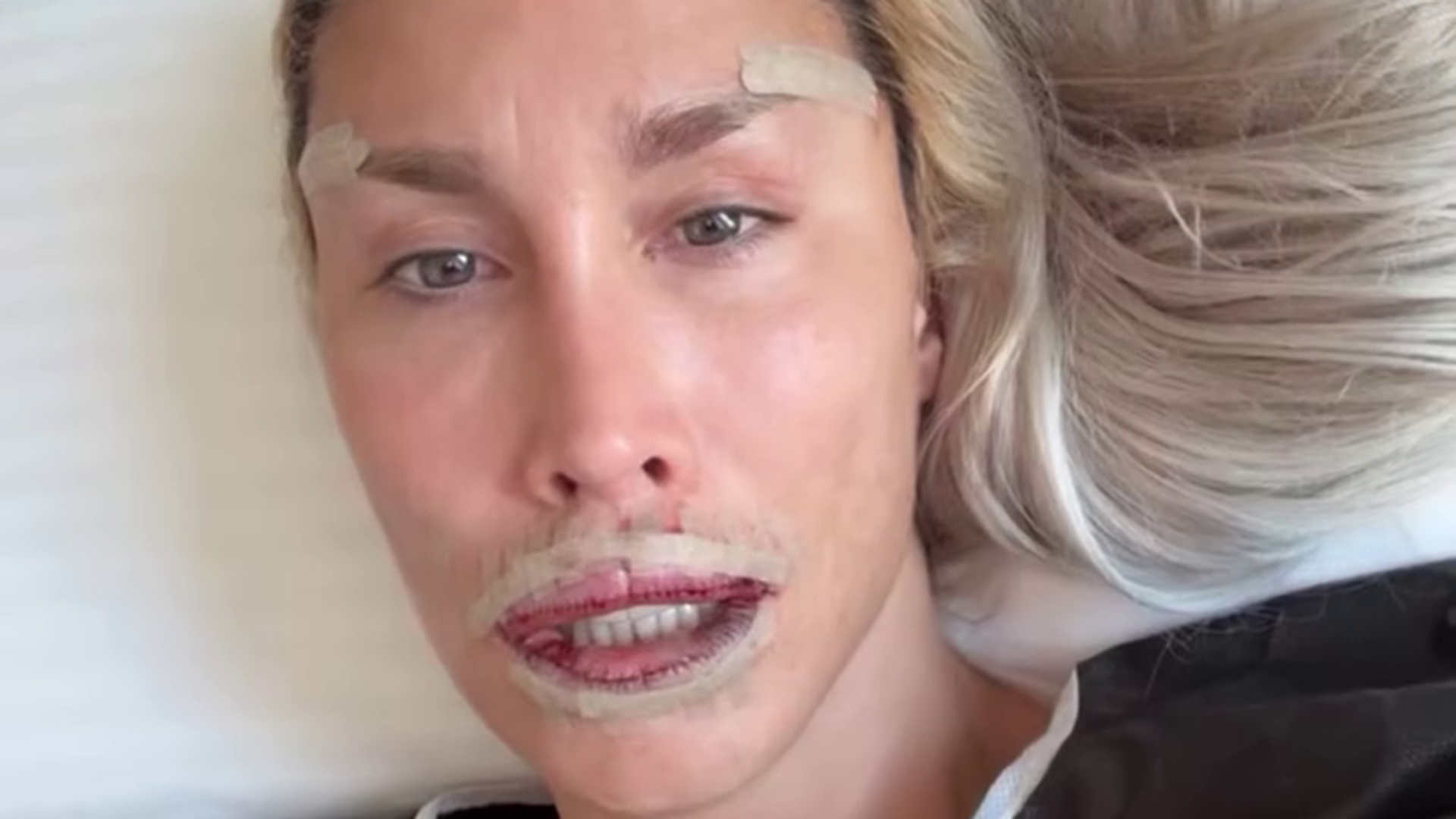 La Pelopony, con los labios cosidos