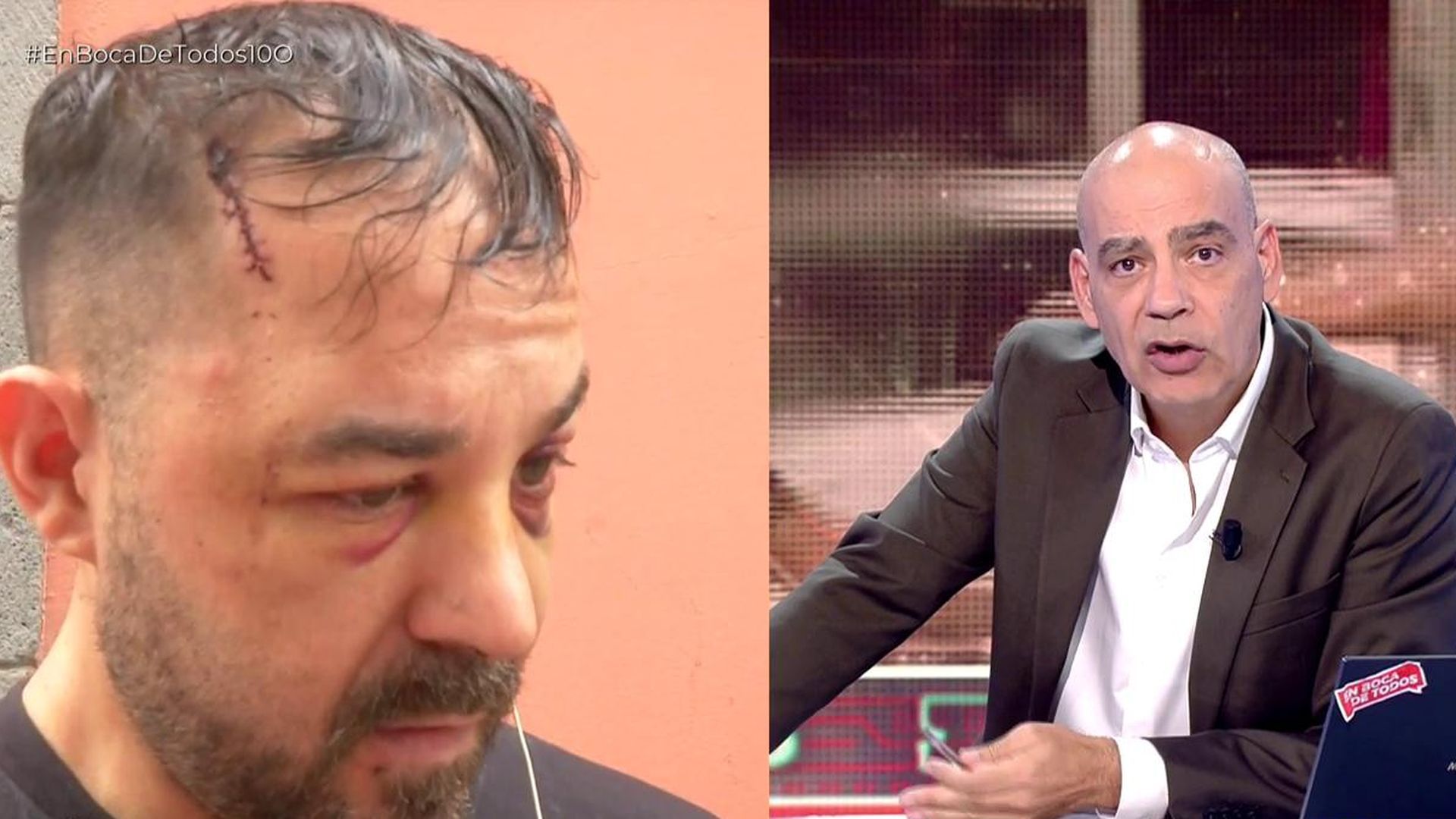 Nacho Abad, al ver las secuelas de Luis tras recibir una salvaje paliza: "Tienes los ojos reventados en sangre" Nacho Abad, al ver las secuelas de Luis tras recibir una salvaje paliza: "Tienes los ojos reventados en sangre"