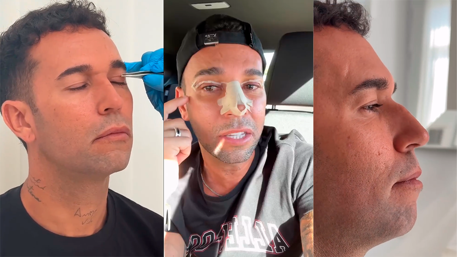 Omar Sánchez explicando por qué se ha operado