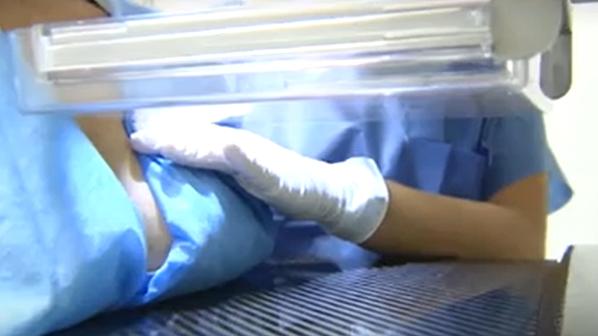 Prueba de detección precoz del cáncer de mama