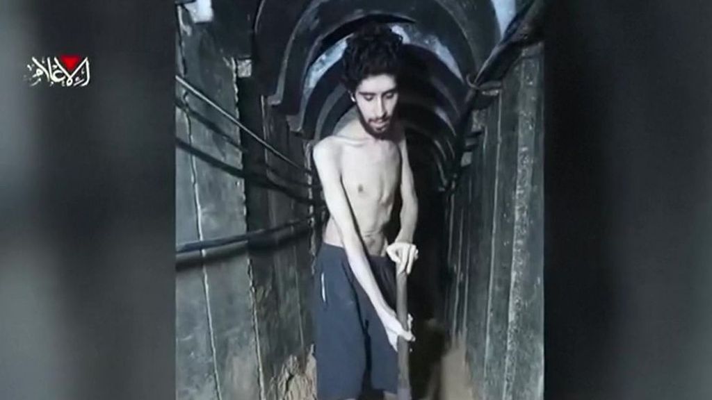 El duro regreso de los últimos 20 rehenes con vida liberados por Hamás: secuelas físicas y psicológicas difíciles de superar