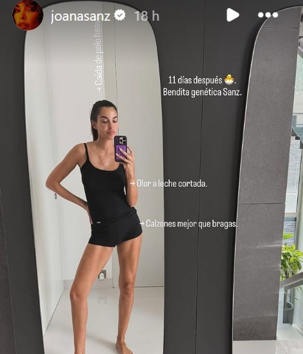 La historia de Joana Sanz