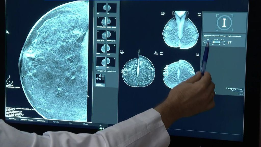 El nuevo consejero de Sanidad andaluz promete cambios en los programas de cribado de cáncer a pesar de la falta de radiólogos