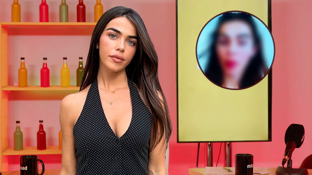 La posible causa de las nuevas marcas en la cara de Violeta Mangriñán En todas las salsas Temporada 8 Top Vídeos 812