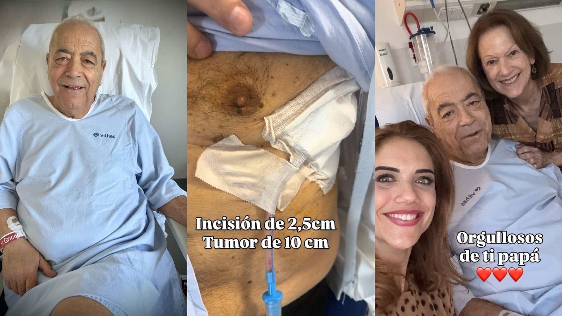 El padre de Beatriz Trapote, horas después de extirparle un tumor de 10 cm en el pulmón