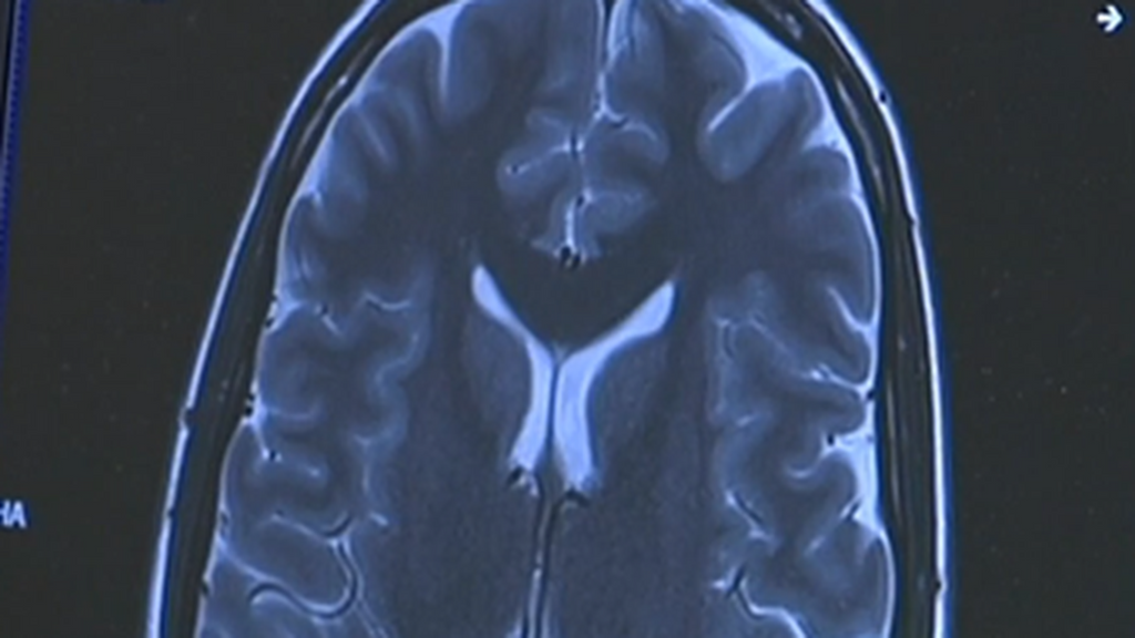 Las consecuencias de la mala alimentación en la vejez: cómo prevenir el deterioro cognitivo