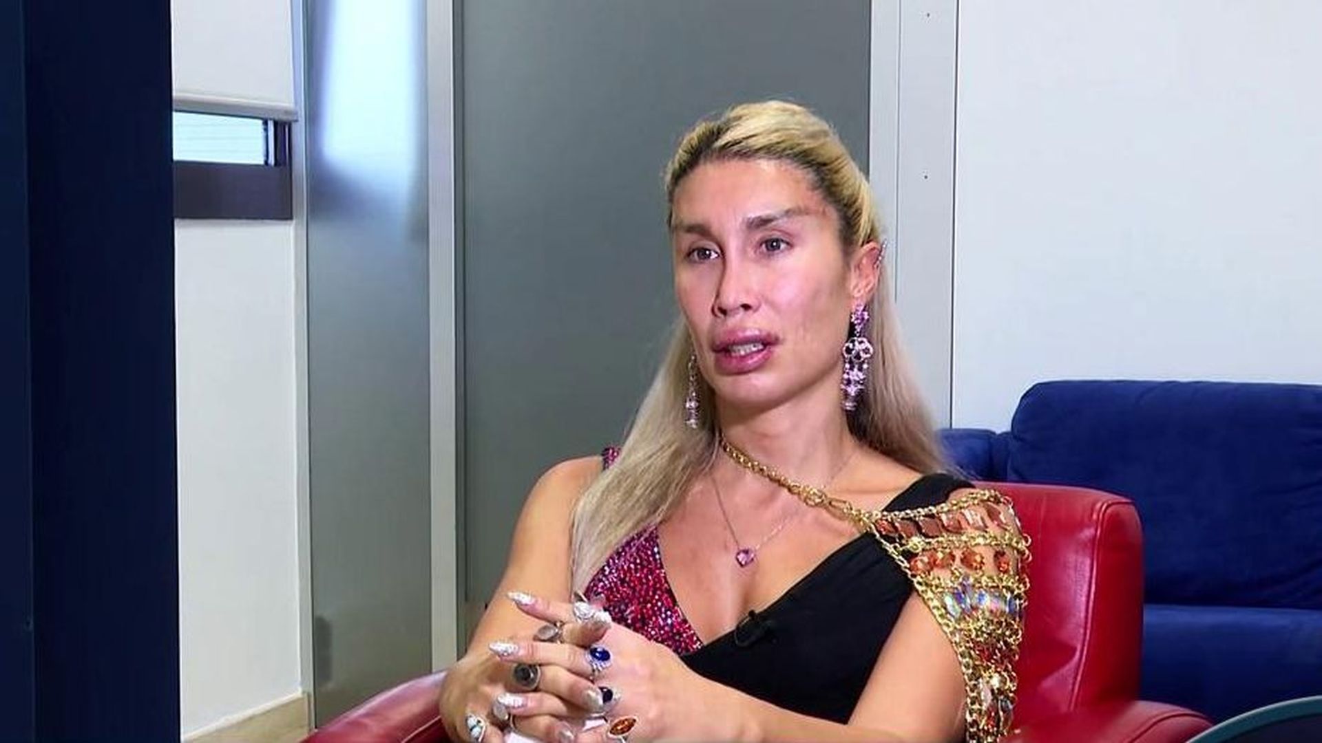 La Pelopony defiende el turismo estético en Turquía y sus pagos en negro tras pasar por quirófano:  "Me iría diez mil veces más"