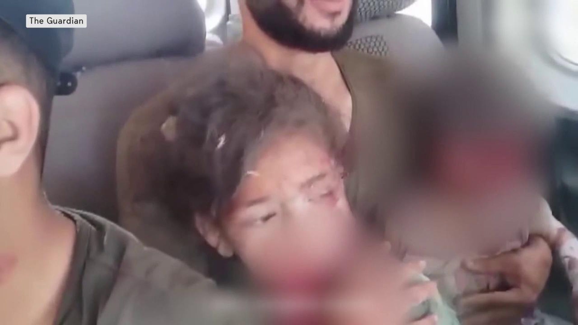 Mazionah tras el ataque