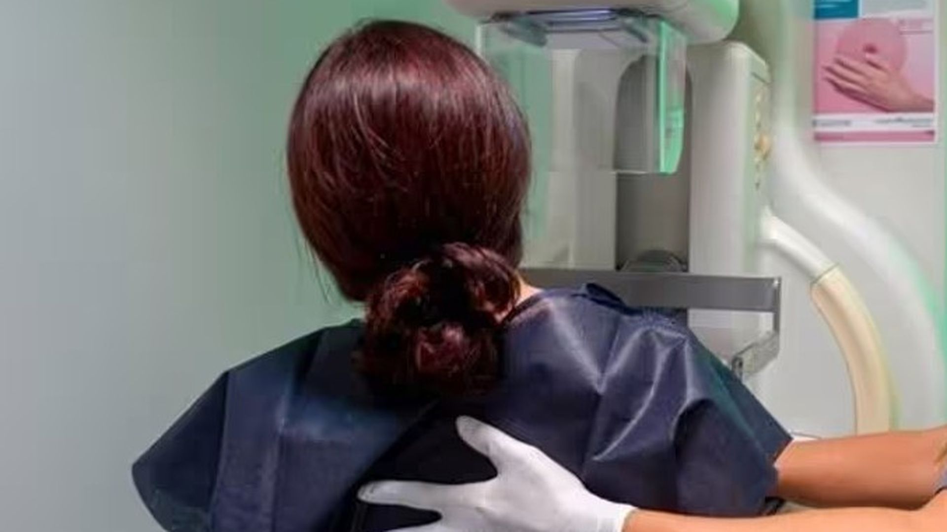 Una nueva terapia mejora los resultados en pacientes con cáncer de mama precoz de alto riesgo