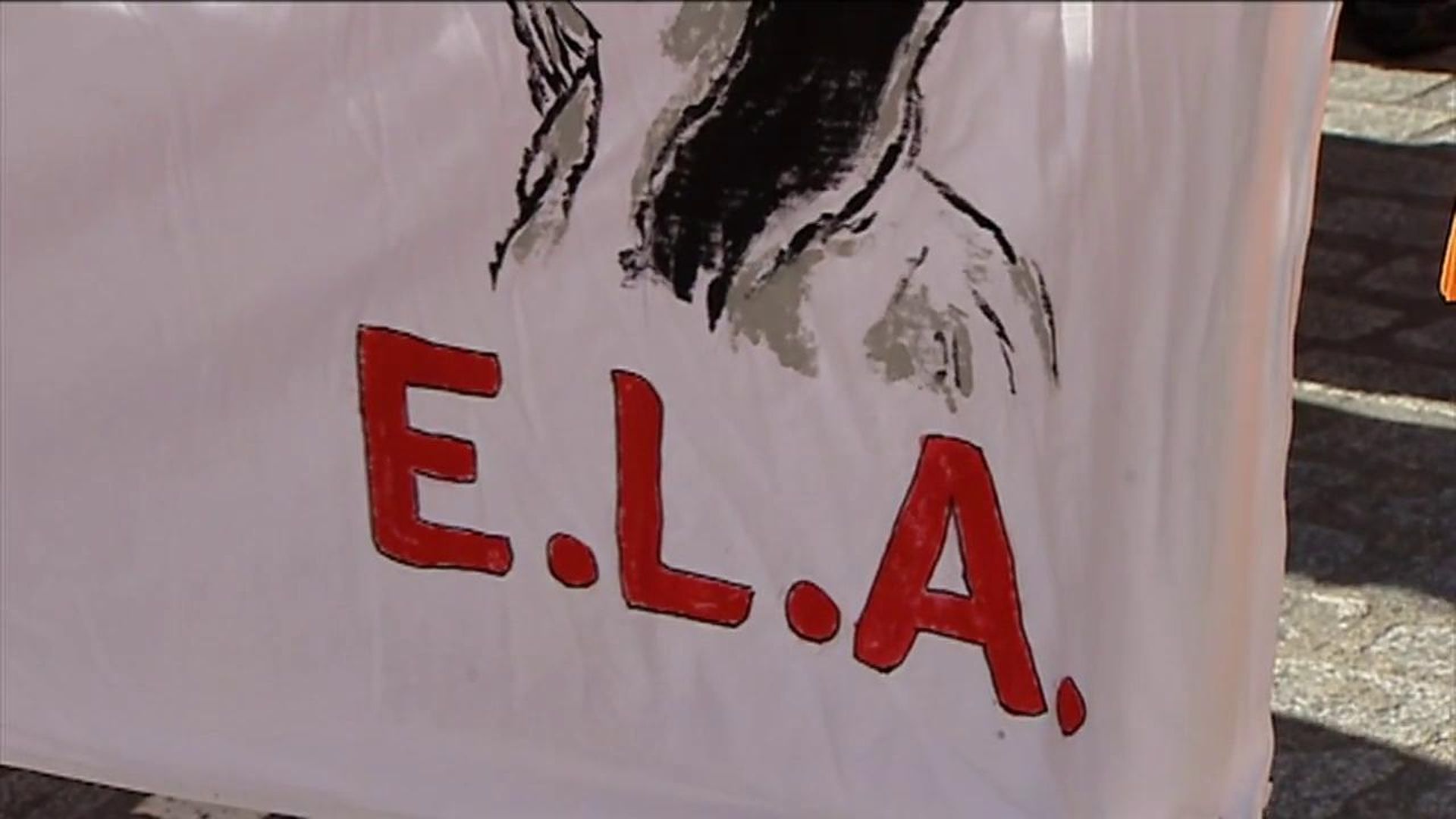 La ayuda de 10.000 euros al mes para pacientes de ELA