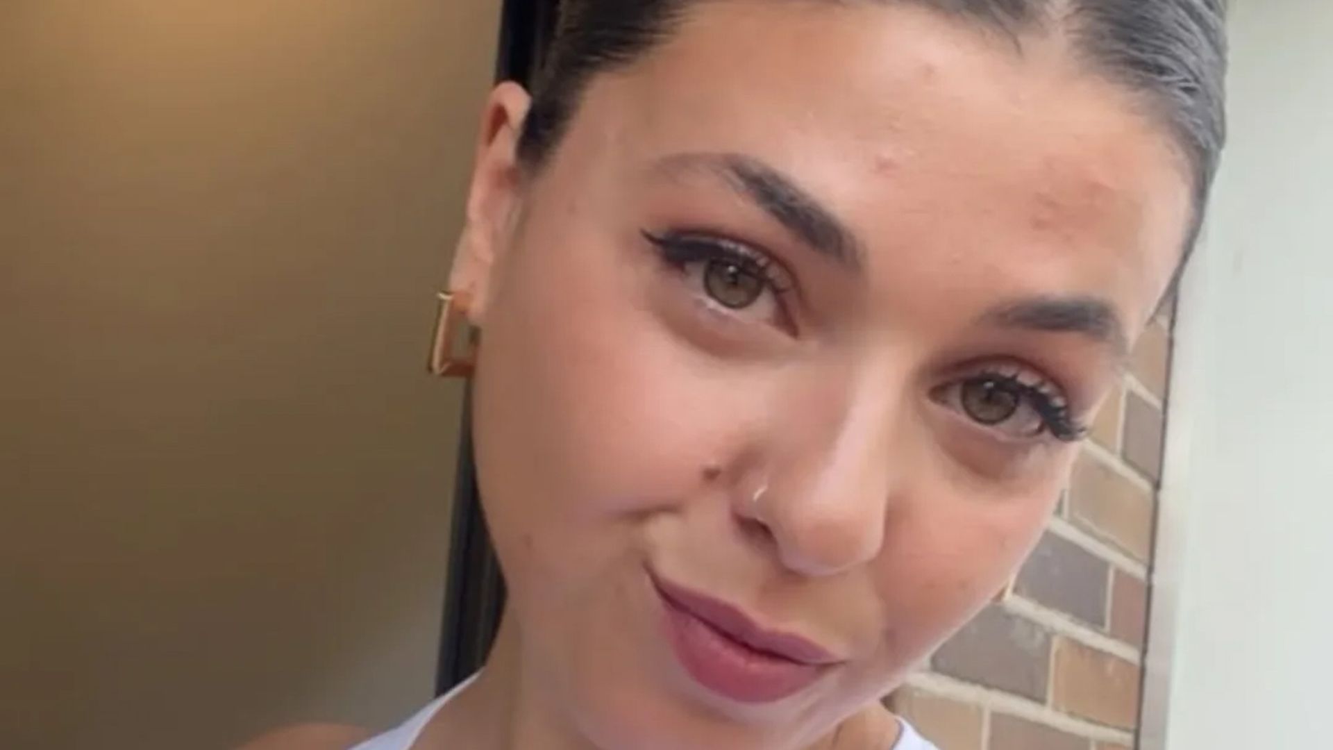 Lola Mencía se somete a una segunda liposucción y cuenta todos los detalles