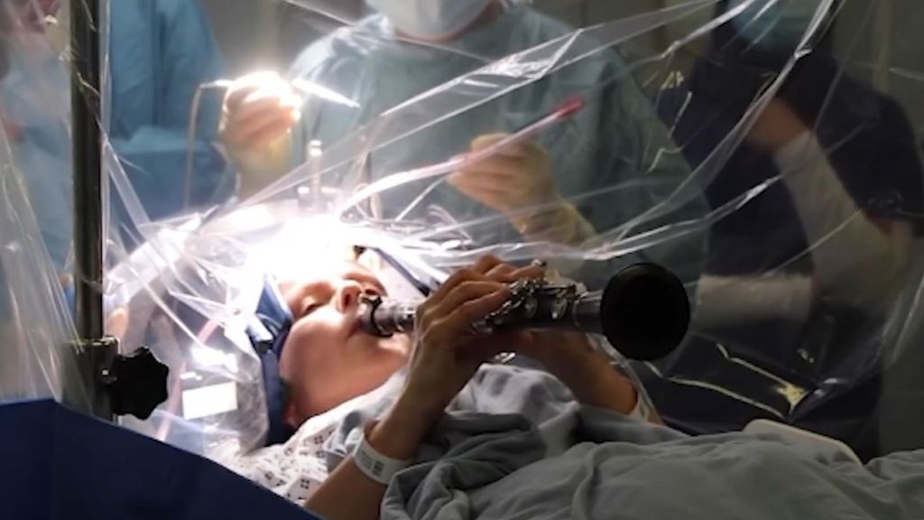 La mujer que toca el clarinete mientras le operan el cerebro