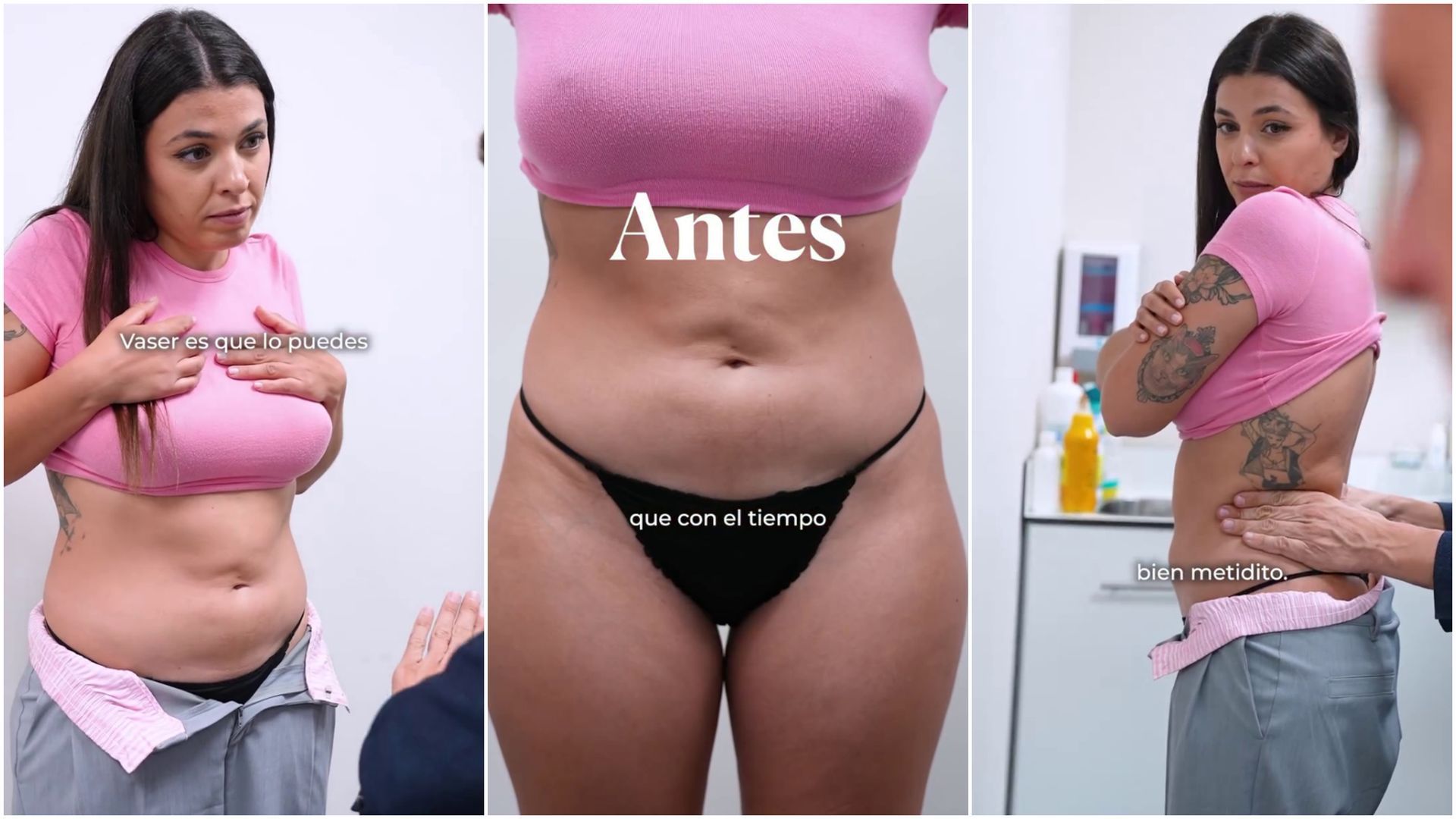 Lola Mencía muestra el antes de su segunda liposucción: las fotos