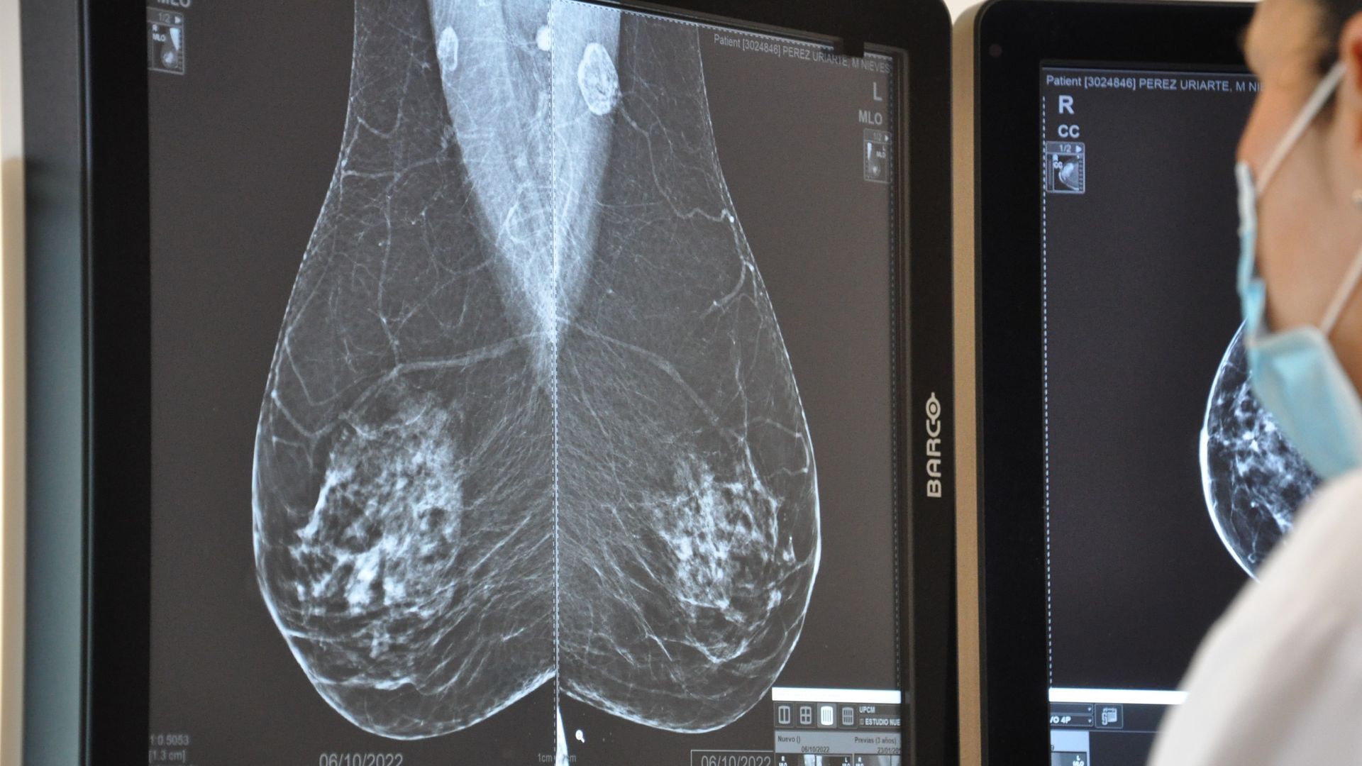 La Fiscalía investigará los cribados del cáncer en Andalucía y pide un informe a la Junta