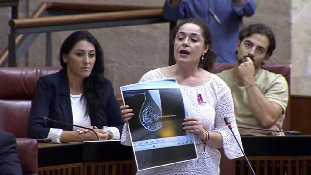La teta de Anabel llega al Parlamento: Por Andalucía muestra una mamografía supuestamente manipulada