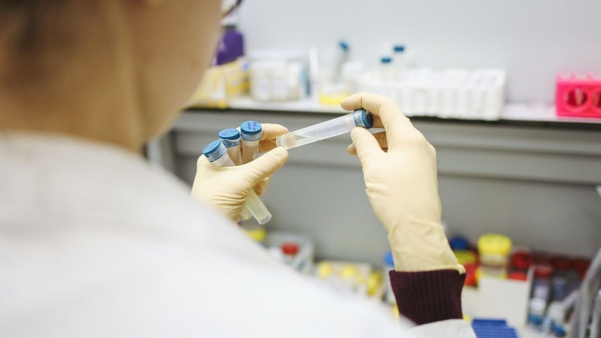 Un informe confirma que la saliva ayuda a predecir la evolución del cáncer de cabeza y cuello: "Puede decirnos cómo responde al tratamiento"