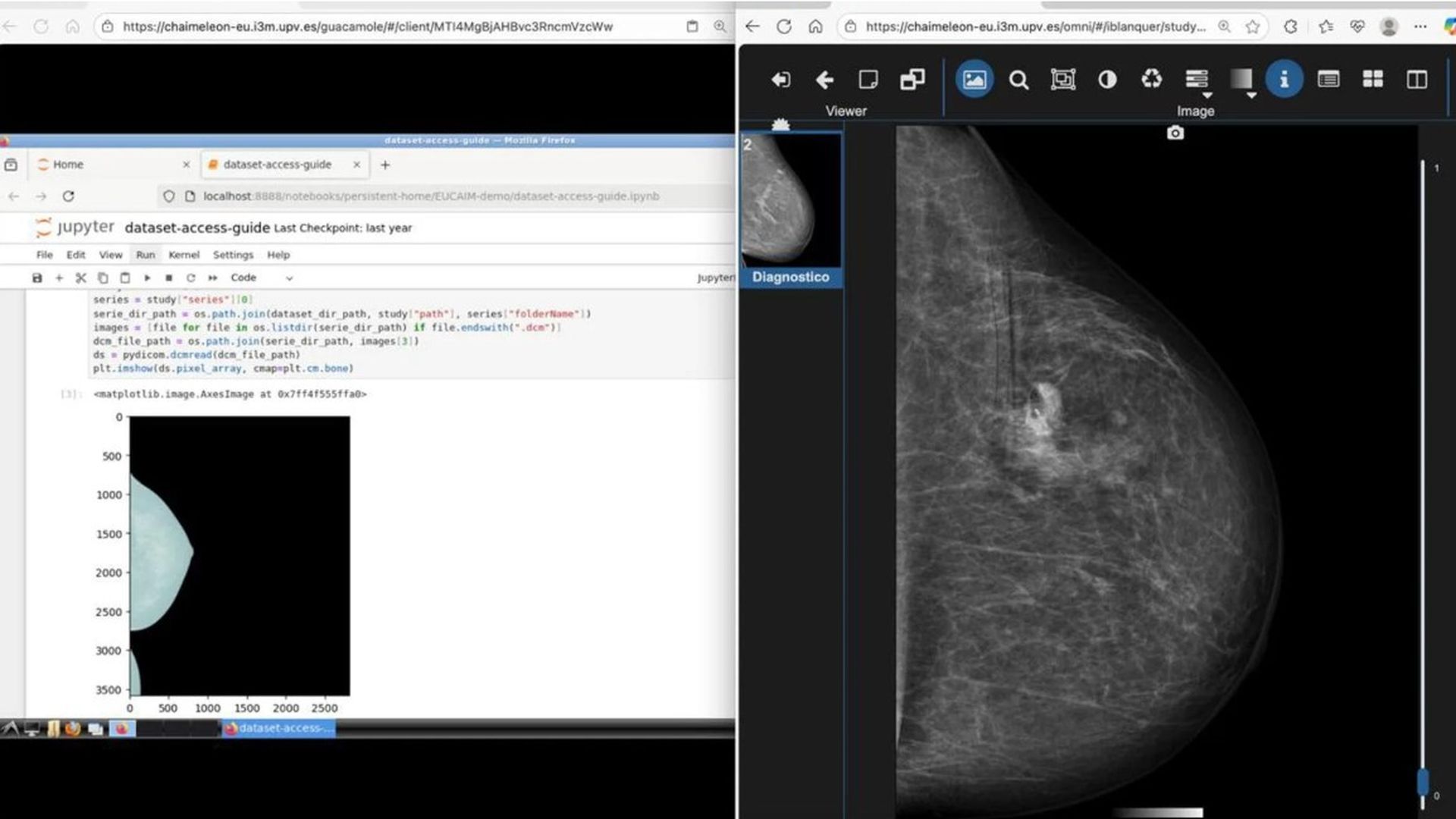 Imagen de una mamografía