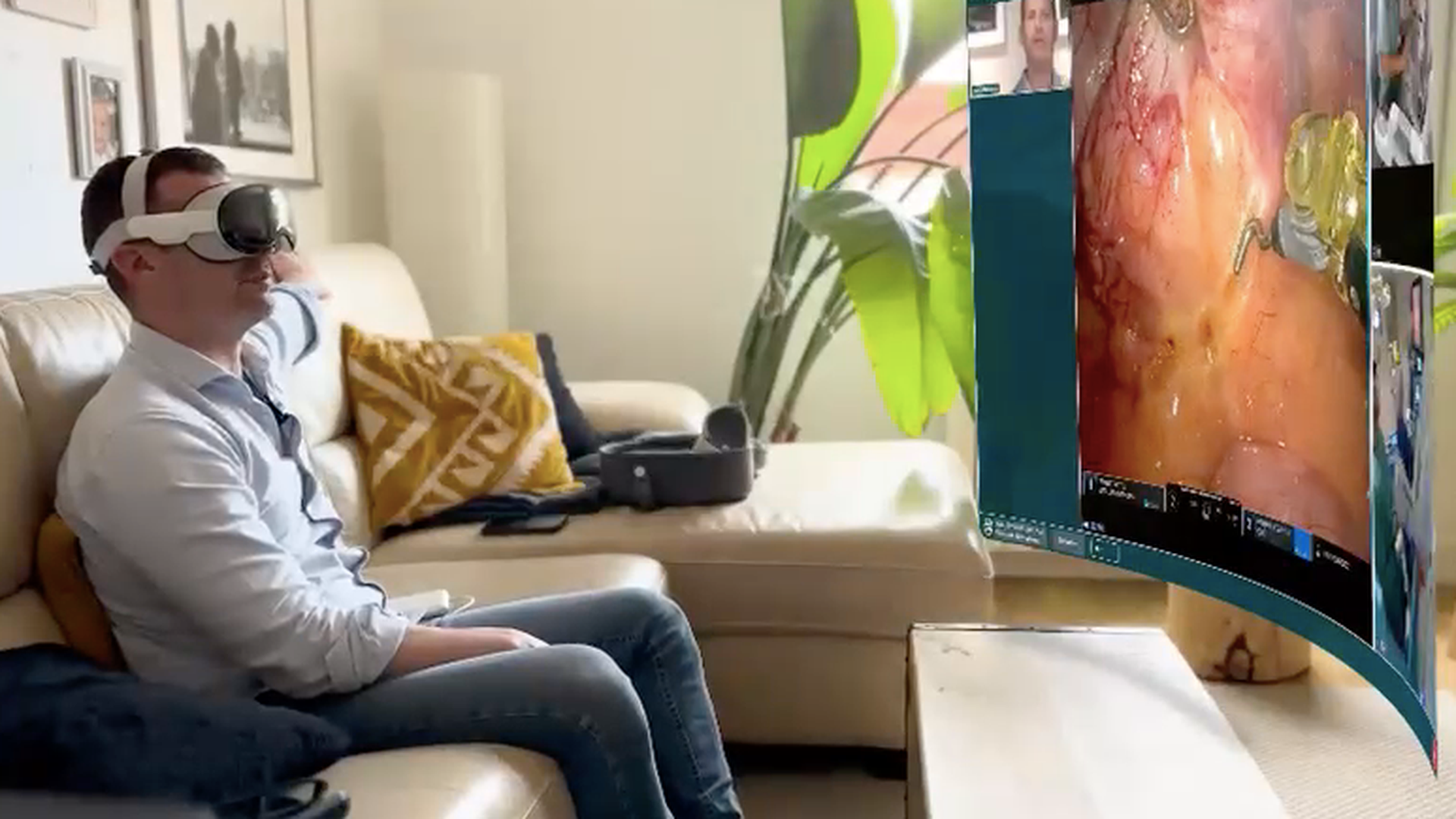 Supervisar una cirugía de urgencia desde el sofá: así se logró el hito europeo de un hospital catalán