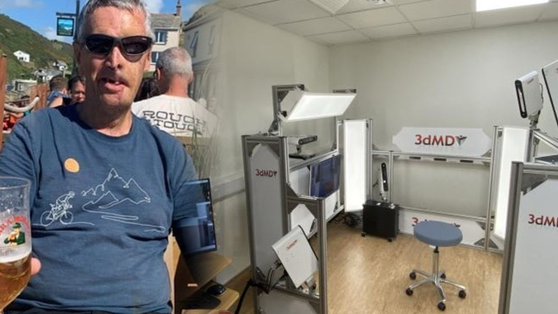 Un hombre recupera la mitad de su cara perdida en un accidente de tráfico gracias a una prótesis 3D: "Es surrealista"