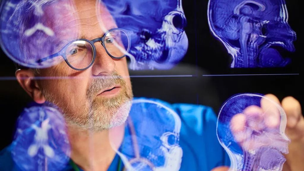 apertura alzheimer avances