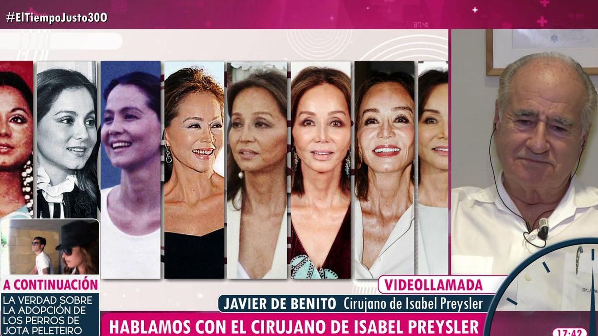 Javier de Benito, el cirujano que reconstruyó la nariz de Isabel Preysler tras un accidente: "Le dije que había un momento que tenía que parar"
