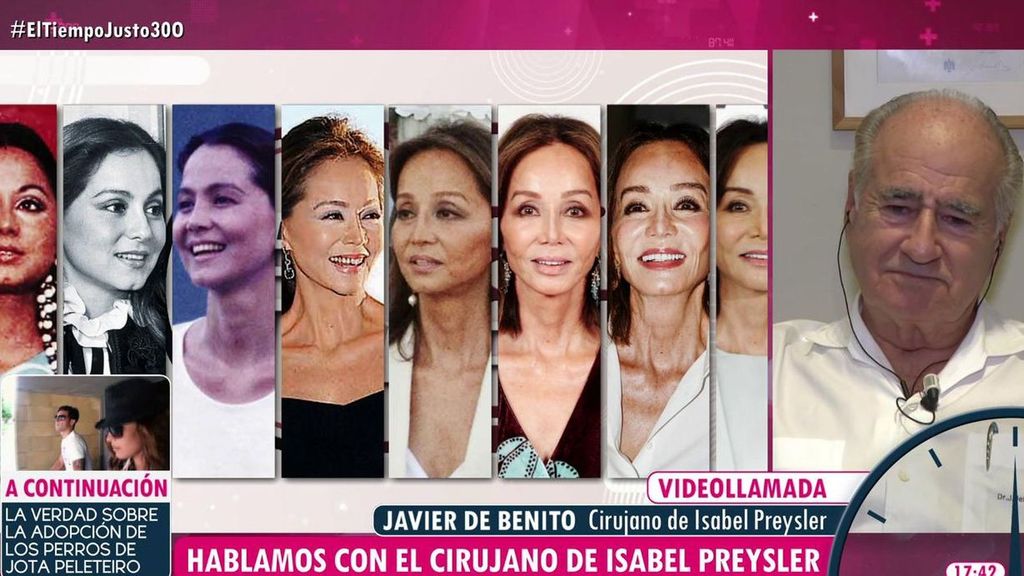 Javier de Benito, el cirujano que reconstruyó la nariz de Isabel Preysler tras un accidente: "Le dije que había un momento que tenía que parar"