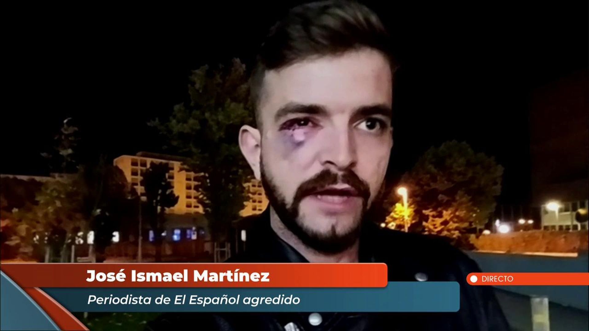 El periodista agredido en Pamlona: “Si no llego a correr, no sé qué habría pasado”