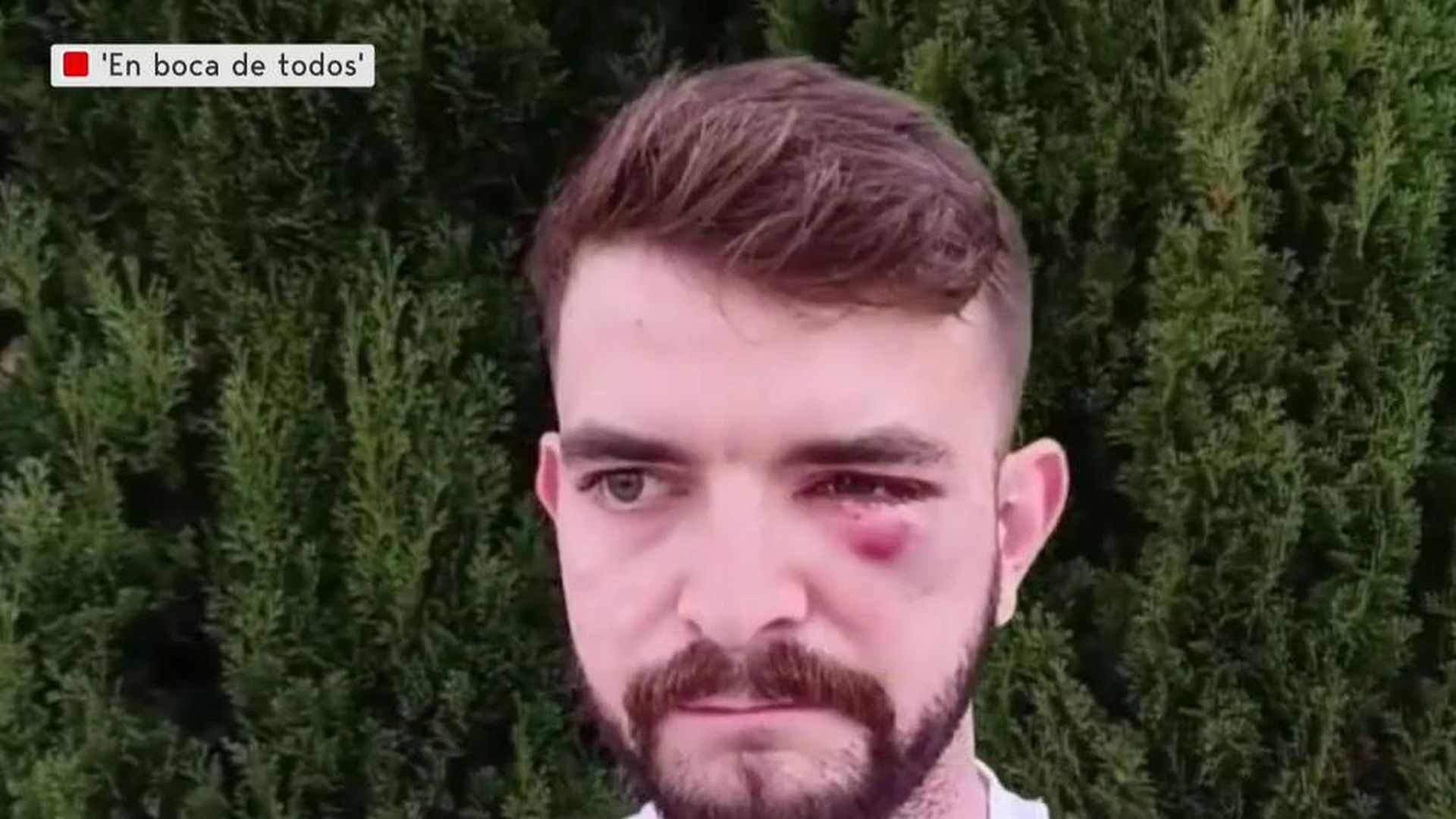 Radicales de izquierdas apalizan a un periodista en su batalla campal en la universidad contra Vito Quiles