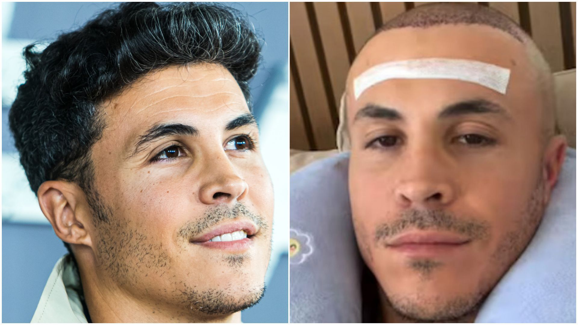 Todos los retoques de Kiko Jiménez más allá del injerto capilar: 30.000 euros invertidos