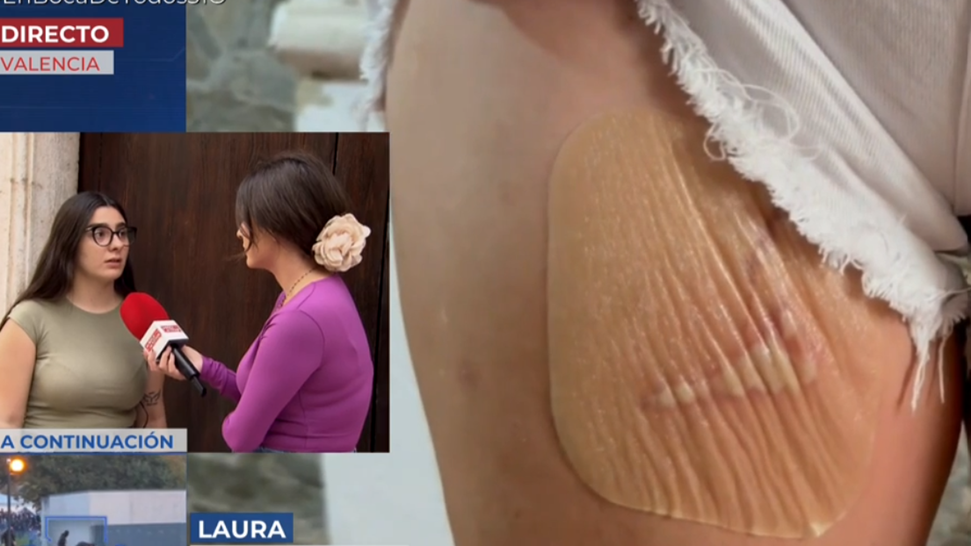 Tres nuevos imputados por torturar a una mujer quemando sus zonas íntimas: "Es imposible llevar una vida normal" Tres nuevos imputados por torturar a una mujer quemando sus zonas íntimas: "Es imposible llevar una vida normal"