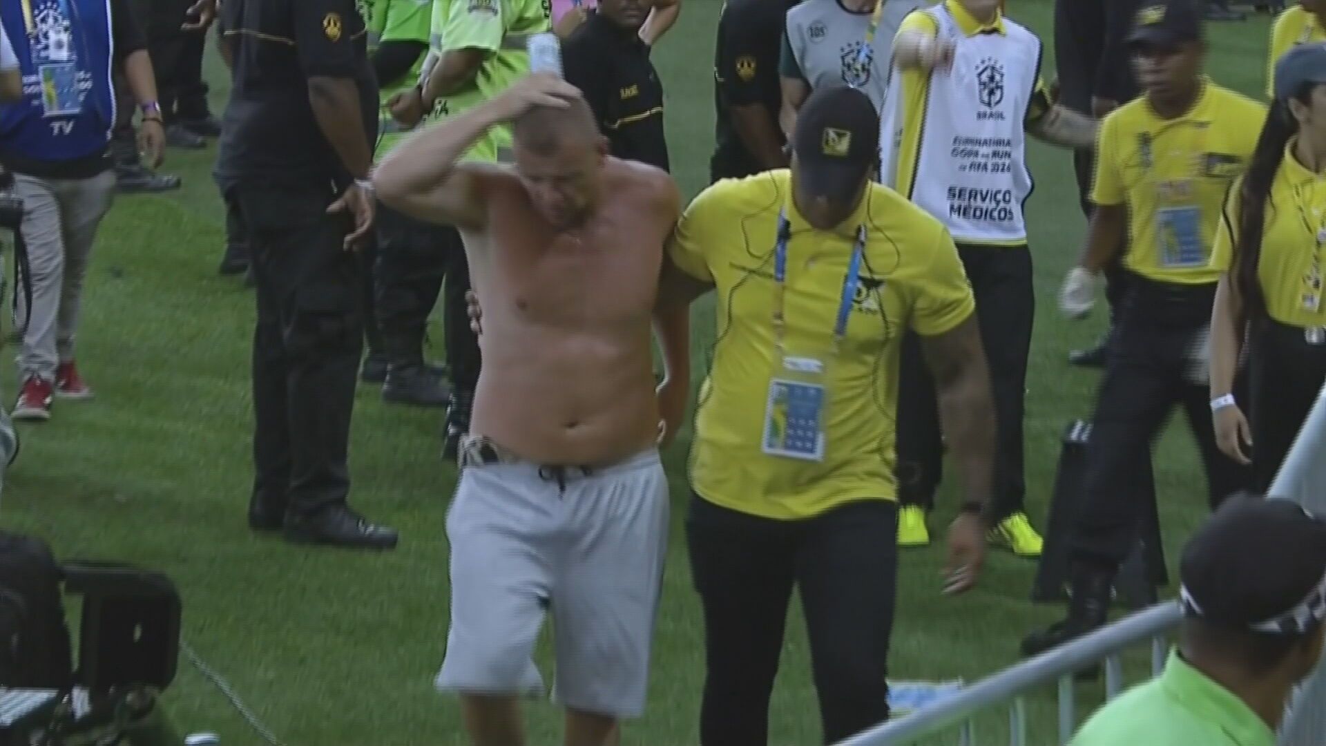 Aficionado argentino con una brecha en la cabeza.