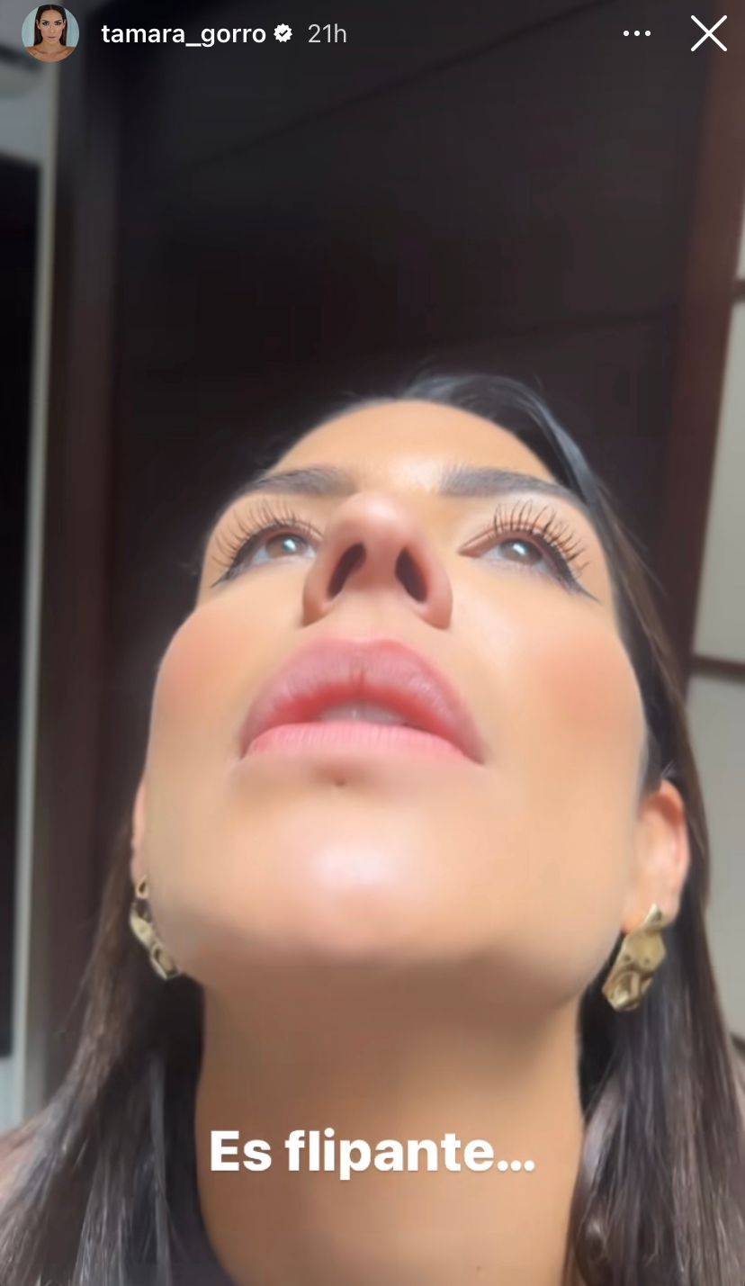 Tamara Gorro muestra a sus seguidores el estado de su nariz antes de la operación (@tamra_gorro)