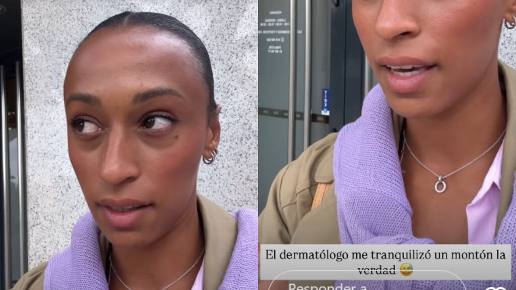  Fotomontaje de Ana Peleteiro contando la importancia de ir a dermatólogo (Foto:@apeleteirob)