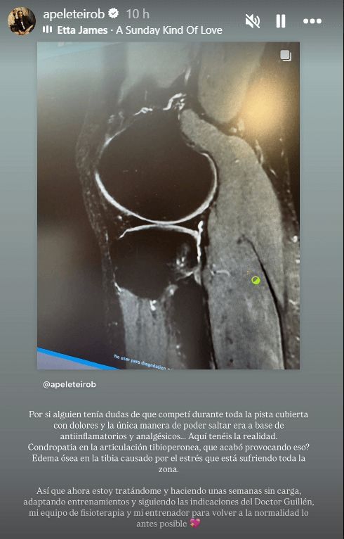  Ana Peleteiro desvela su lesión