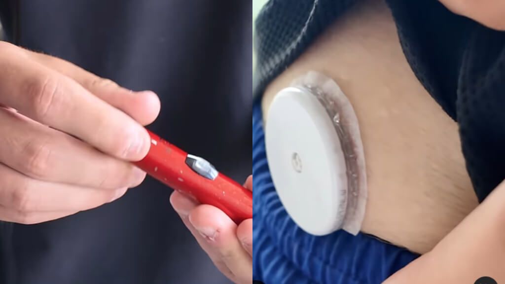  Pluma de insulina y medidor continuo de glucosa de Roberto Galindo