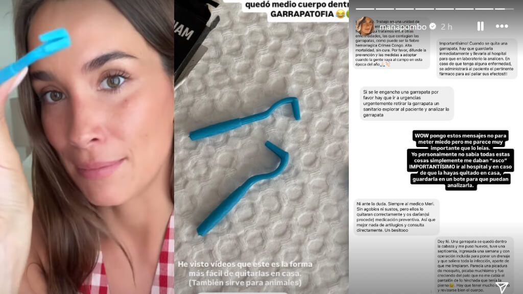 María Pombo, alerta sobre las picaduras de las garrapatas