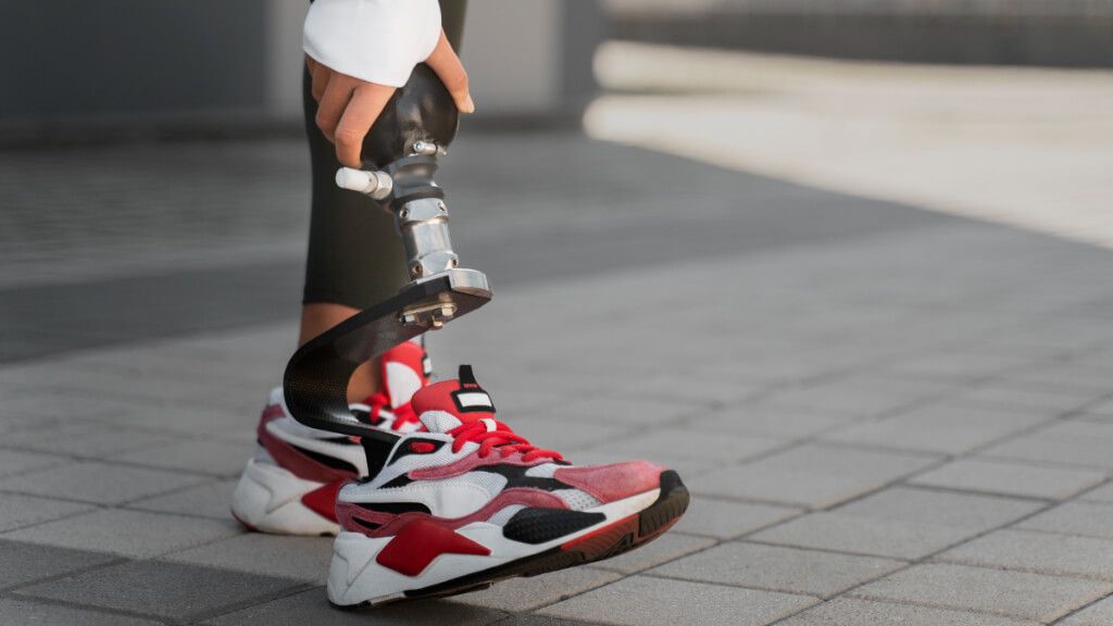 Mujer con una prótesis en su pierna derecha