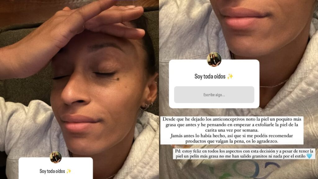  Ana Peleteiro muestra los efectos de dejar los anticonceptivos