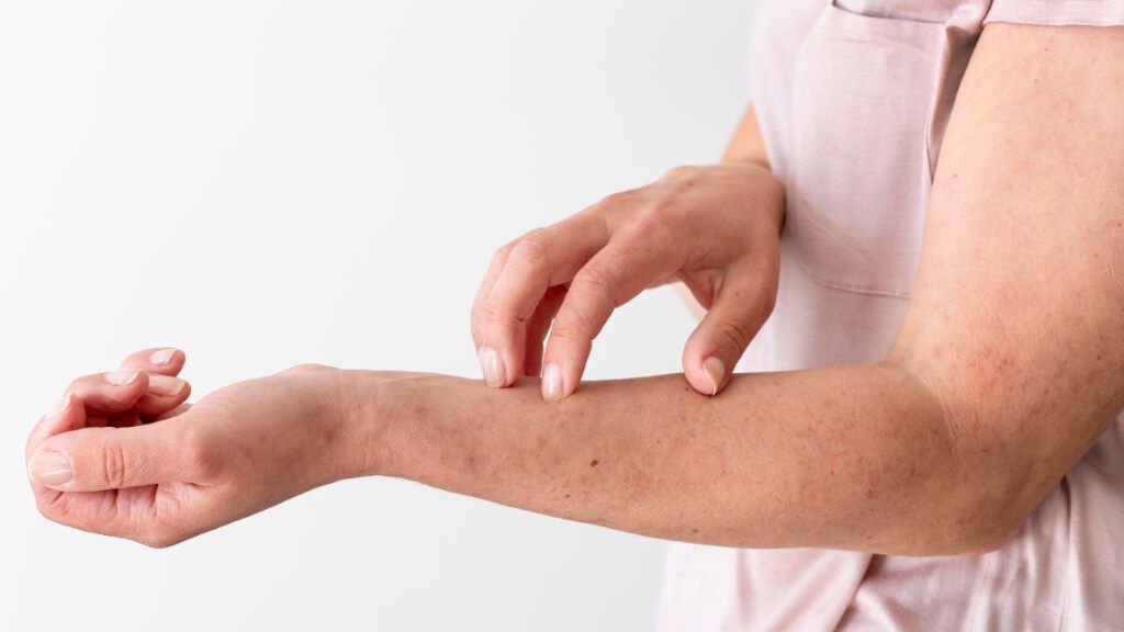  Mujer rascándose la piel