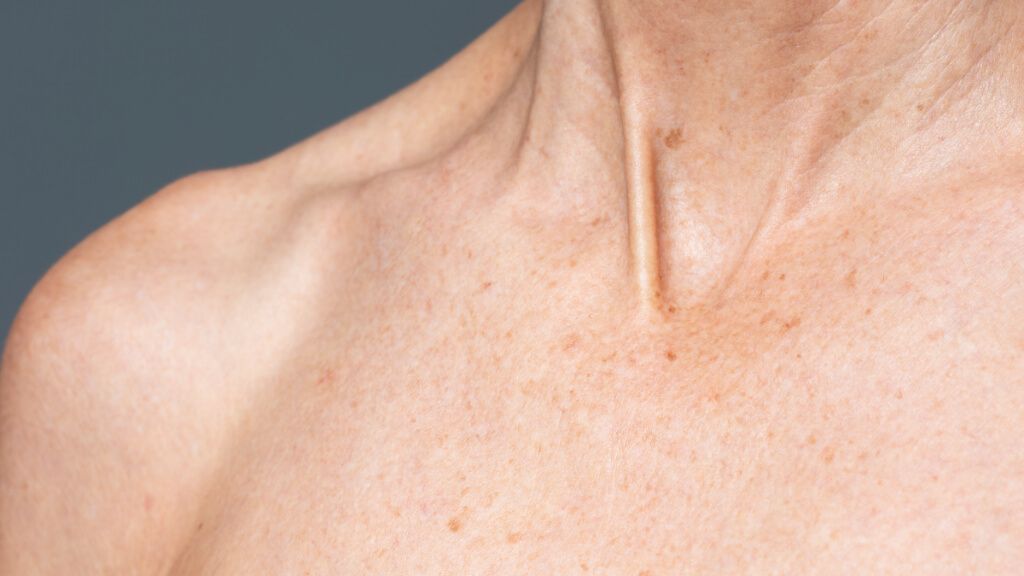 Textura de la piel de una mujer mayor