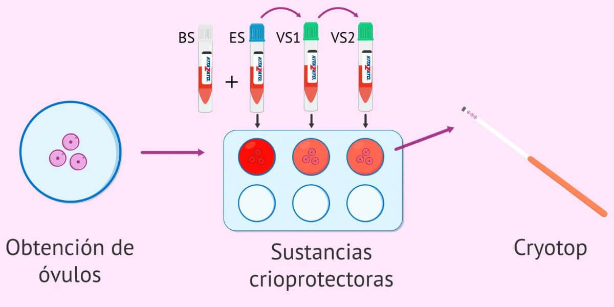 Proceso de vitrificación de óvulos