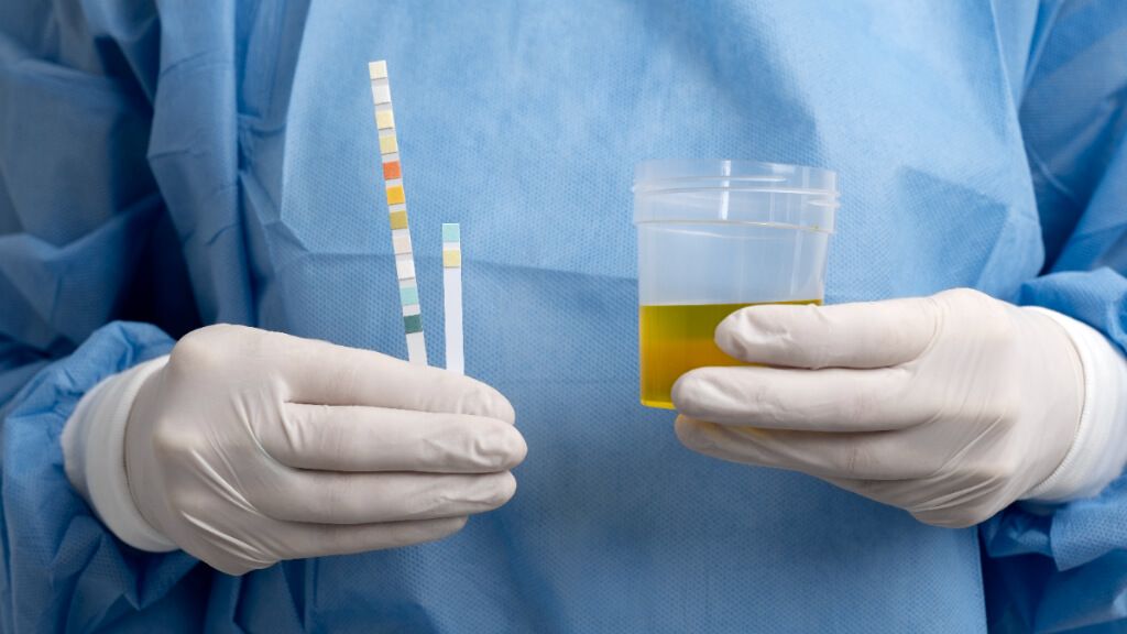 Profesional sanitario con una prueba de orina