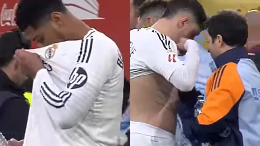  Jugadores del Real Madrid utilizando Vicks VapoRub