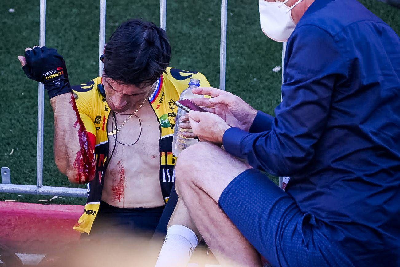 Primoz Roglic, tras su caída en La Vuelta a España 2022.