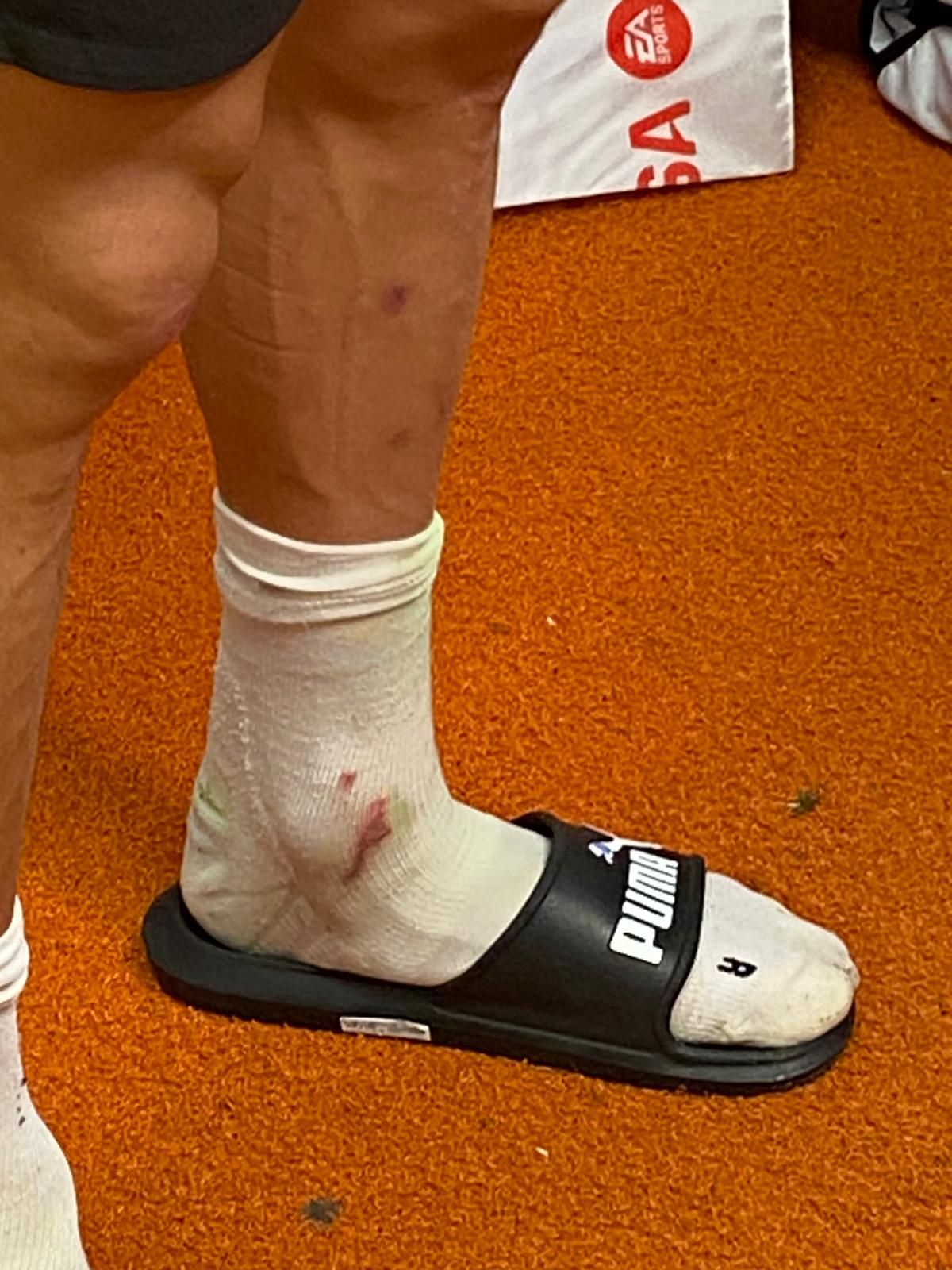  El tobillo de Pepelu