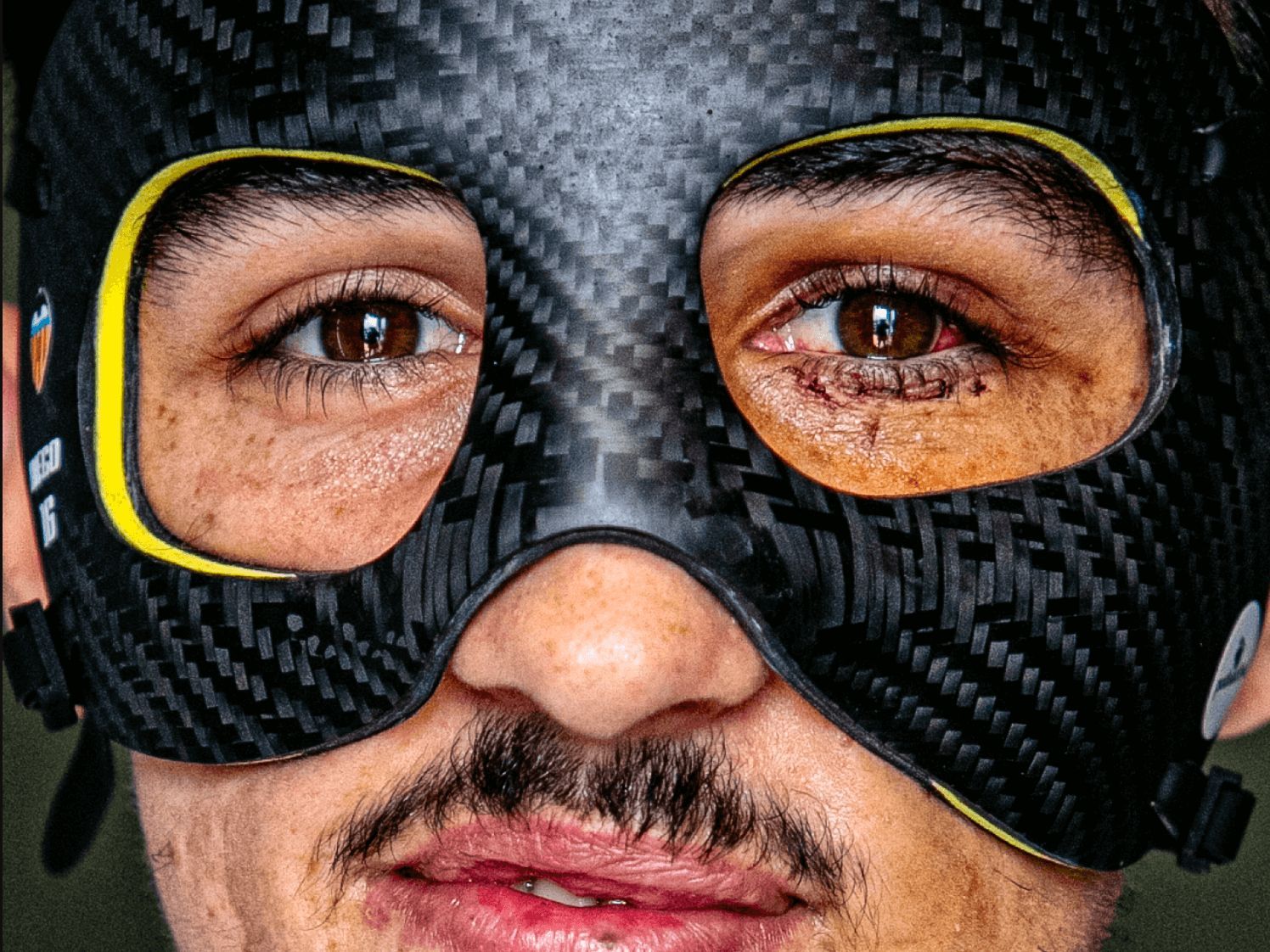 Diego López, con su máscara