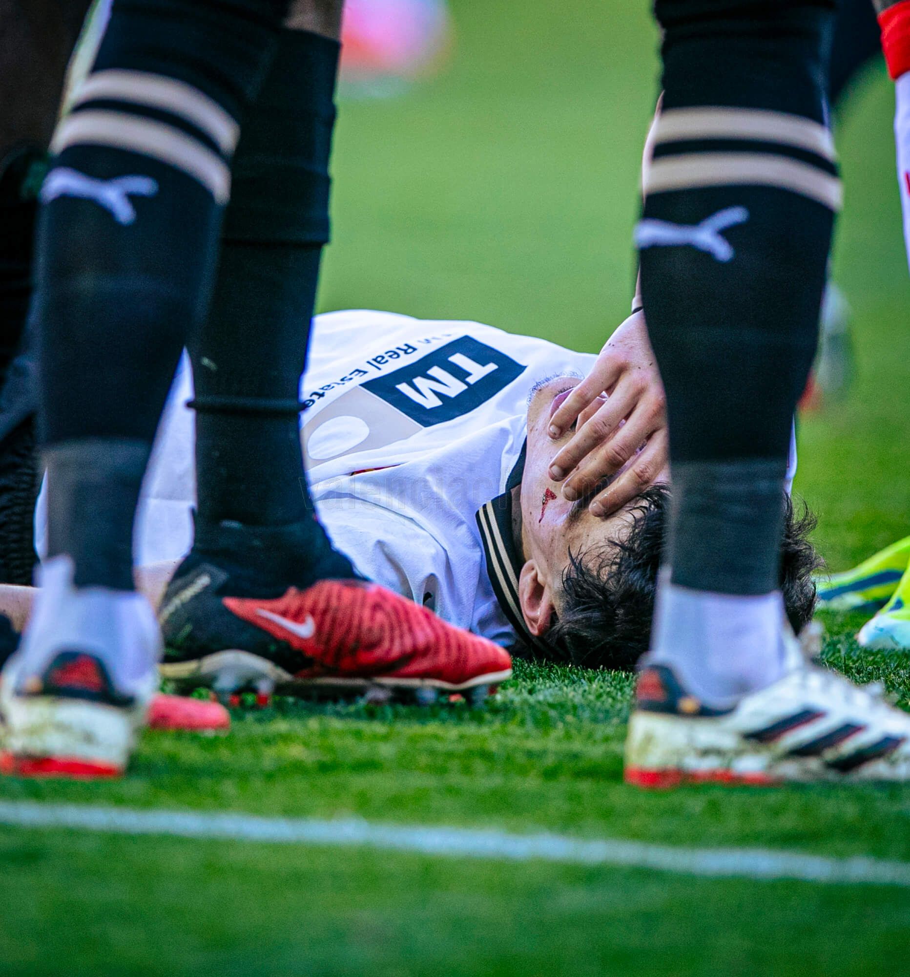  El momento exacto de la fractura de Diego López.