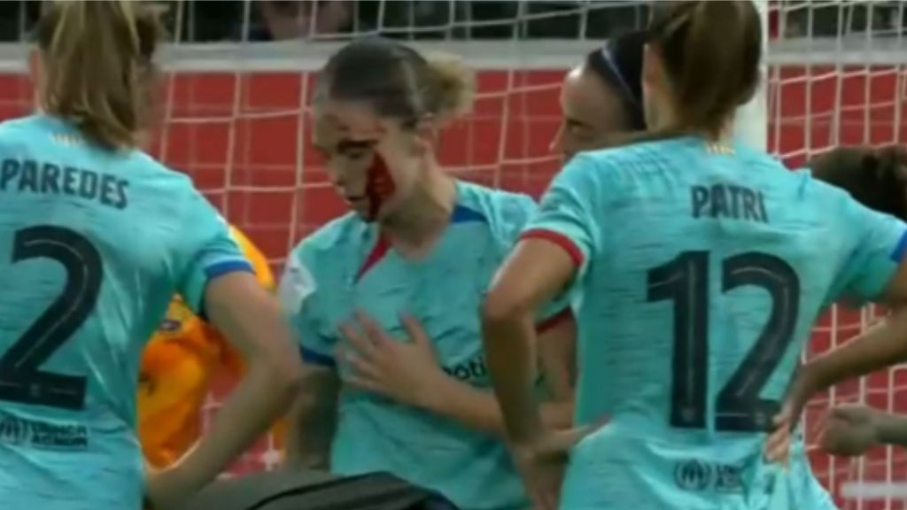 Mapi León sangrando tras un codazo. (Fuente: @DAZN)